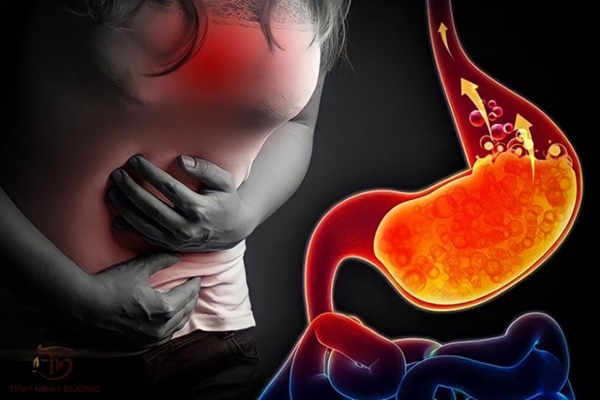 Các nguyên nhân gây trào ngược dạ dày thực quản ít người biết